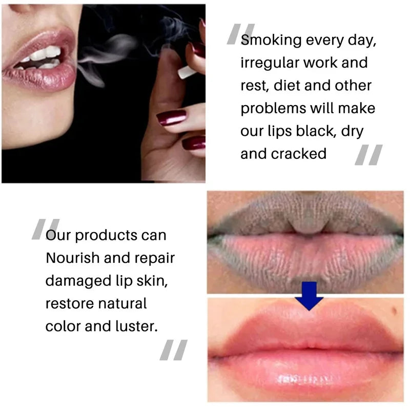 Remove Dark Smoke Lip Balm Lightening Melanin Bleaching Gloss Oil Lips Pink Lipstick Exfoliating Fade Lip Lines Korean Cosmetics