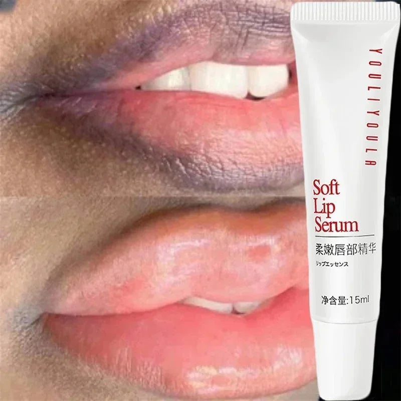 Lip Pink Fresh Lightening Bleaching Cream Treatment Remove Dark Smoke Lips Lip Balm Whitening Moisturizer Nourishing Essence