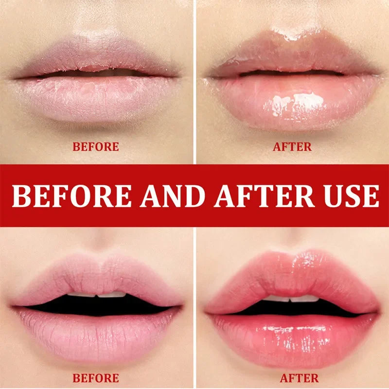 Fast Lightening Lips Pink Cream Fresh Bleaching Treatment Remove Dark Smoke Lips Lip Balm Whitening Moisturizer Nourish Essence