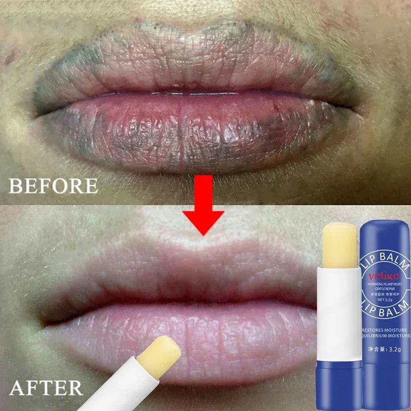 Instantly Lip Balm Remove Dark Lighten Melanin Lip Mask Fade Lip Line Brighten Exfoliating Moisturize Dead Skin Repair Lip Care