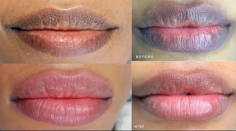 Lips Pink Serum Remove Dark Smoke Lip Plumping Oil Bleaching Melanin Repair Lip Lines Moisturizing Brighten Lip Care Cosmetics