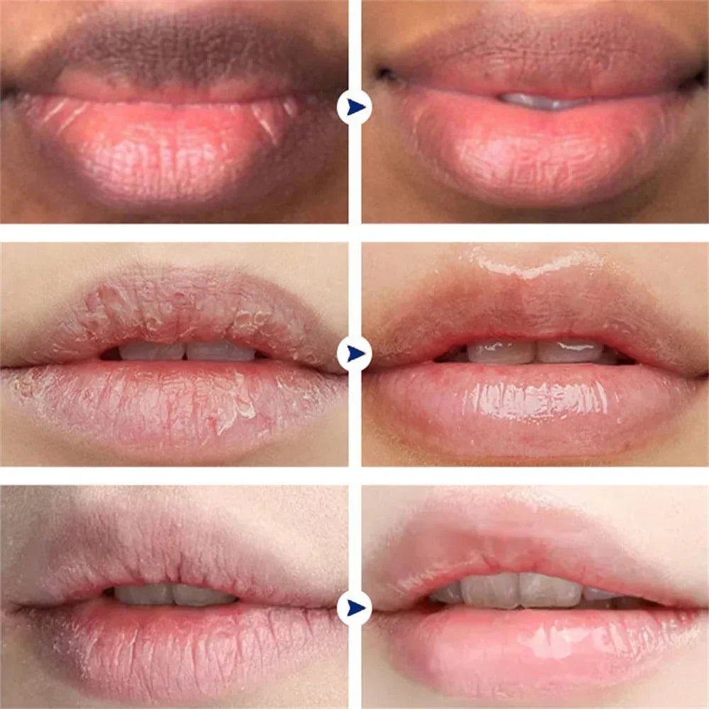 Remove Dark Smoke Lip Balm Lightening Melanin Bleaching Gloss Oil Lips Pink Lipstick Exfoliating Fade Lip Lines Korean Cosmetics