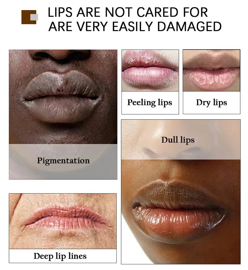 Remove Dark Smoke Lip Balm Lightening Melanin Bleaching Gloss Oil Lips Pink Lipstick Exfoliating Fade Lip Lines Korean Cosmetics