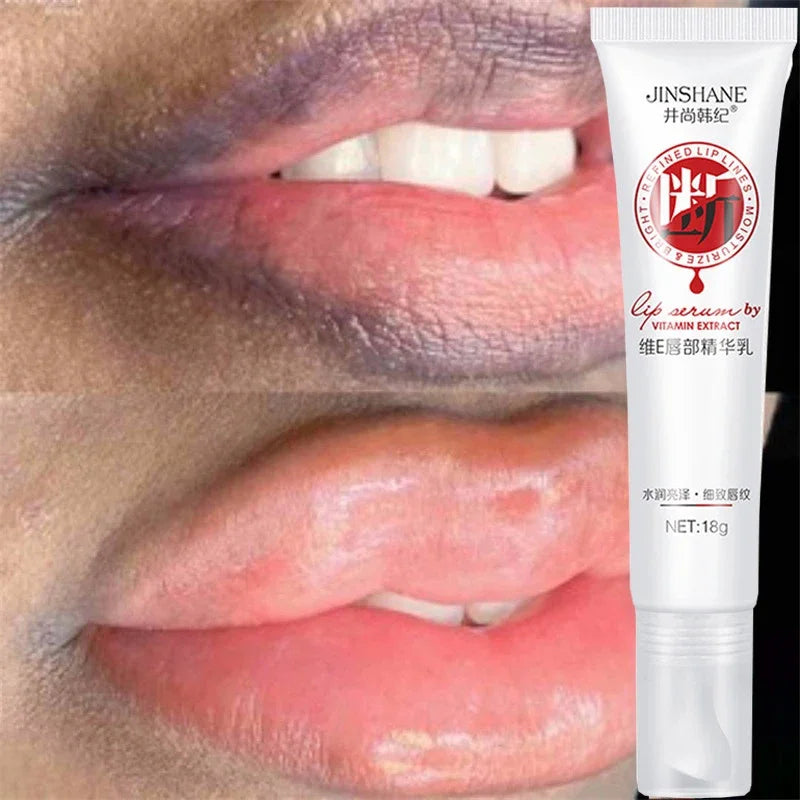 Fast Lightening Lips Pink Cream Fresh Bleaching Treatment Remove Dark Smoke Lips Lip Balm Whitening Moisturizer Nourish Essence