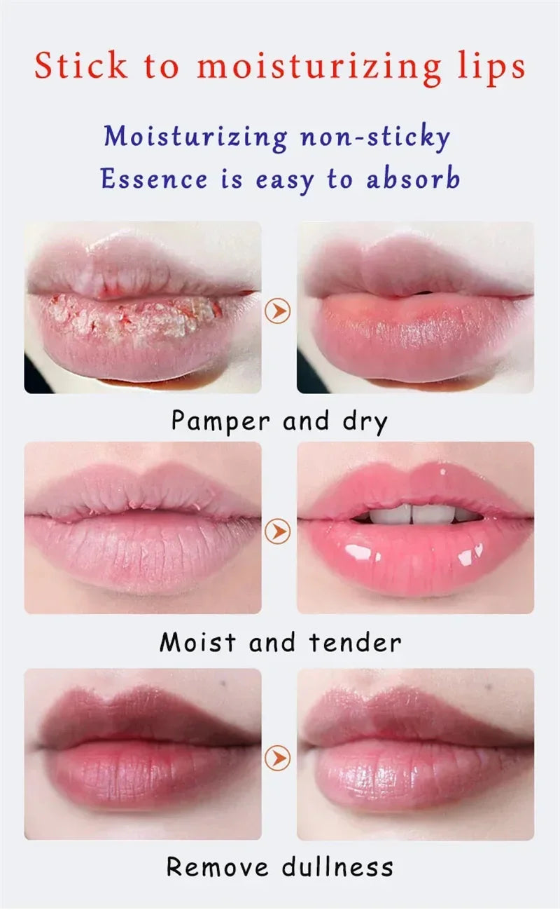 Remove Dark Lip Balm Lightening Melanin Mask Gloss Oil Exfoliating Clean Moisturizer Korean Care Products Makeup Beauty Health