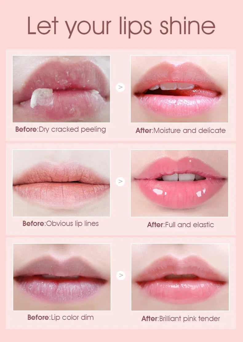 Lip Pink Fresh Lightening Bleaching Cream Treatment Remove Dark Smoke Lips Lip Balm Whitening Moisturizer Nourishing Essence