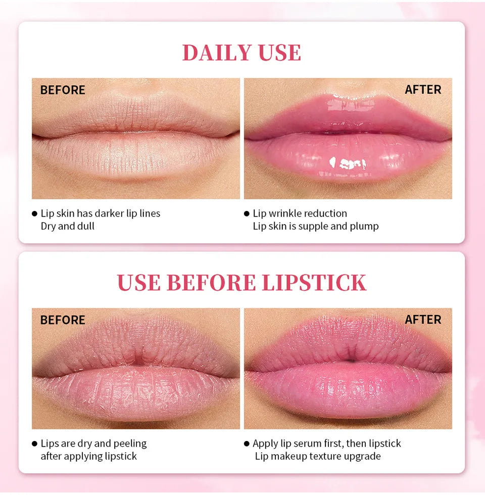 Lips Pink Serum Remove Dark Smoke Lip Plumping Oil Bleaching Melanin Repair Lip Lines Moisturizing Brighten Lip Care Cosmetics