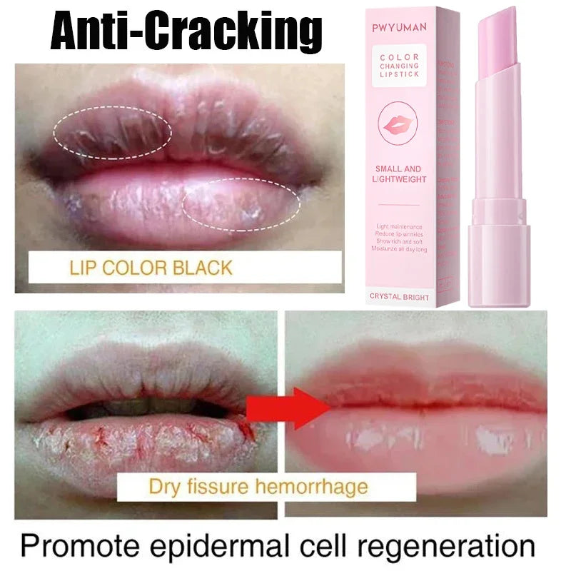 Remove Dark Smoke Lip Balm Lightening Melanin Bleaching Gloss Oil Lips Pink Lipstick Exfoliating Fade Lip Lines Korean Cosmetics