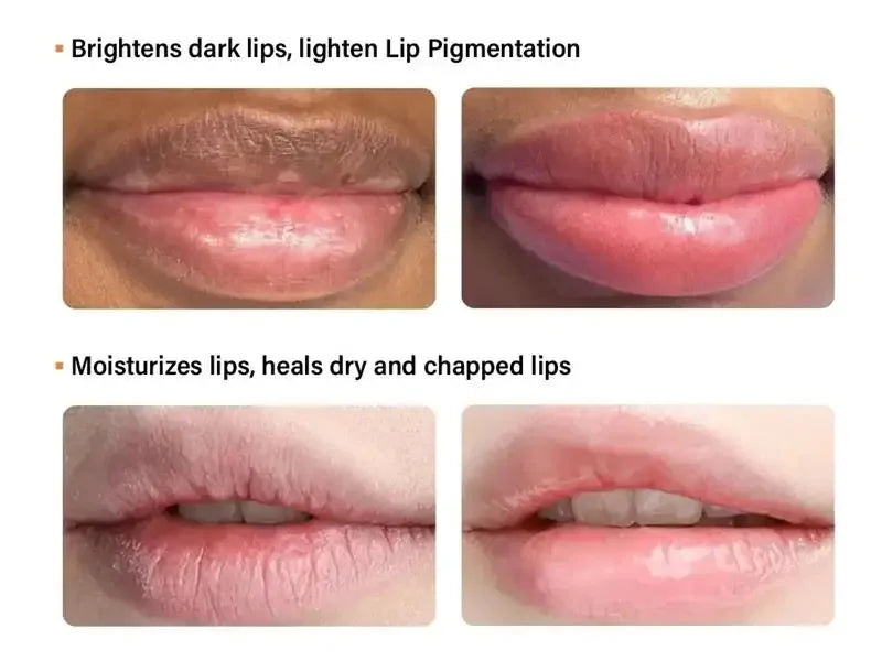 Remove Dark Smoke Lip Balm Lightening Melanin Bleaching Gloss Oil Lips Pink Lipstick Exfoliating Fade Lip Lines Korean Cosmetics