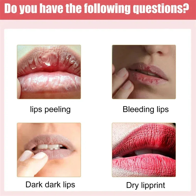 Lip Pink Fresh Lightening Bleaching Cream Treatment Remove Dark Smoke Lips Lip Balm Whitening Moisturizer Nourishing Essence