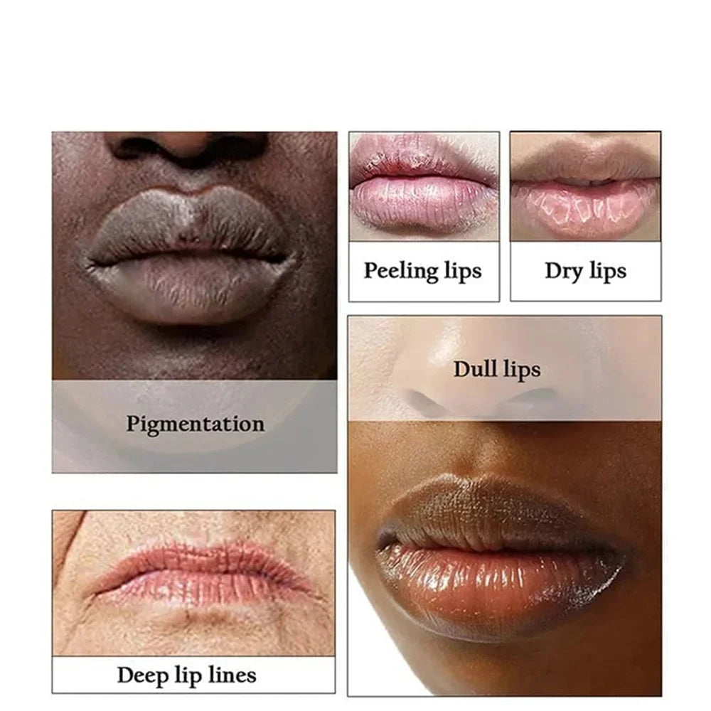 Lip Pink Fresh Lightening Bleaching Cream Treatment Remove Dark Smoke Lips Lip Balm Whitening Moisturizer Nourishing Essence