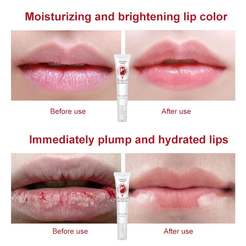 Fast Lightening Lips Pink Cream Fresh Bleaching Treatment Remove Dark Smoke Lips Lip Balm Whitening Moisturizer Nourish Essence